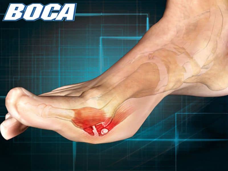 Tổng quan về bệnh đau khớp ngón chân cái